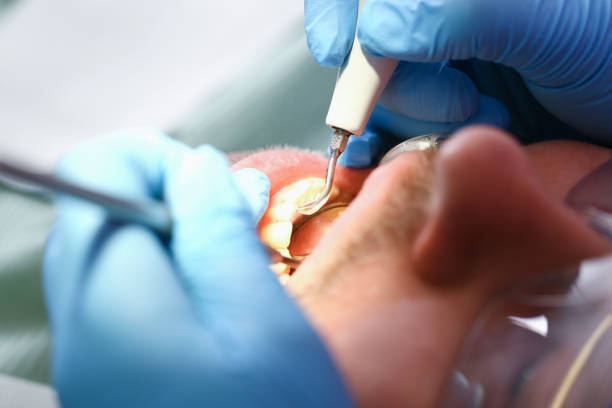 Best Tooth Infection Emergency Dentist  in Garden Home Whitfd, OR