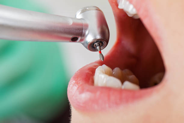 Best Broken Tooth Emergency  in Garden Home Whitfd, OR